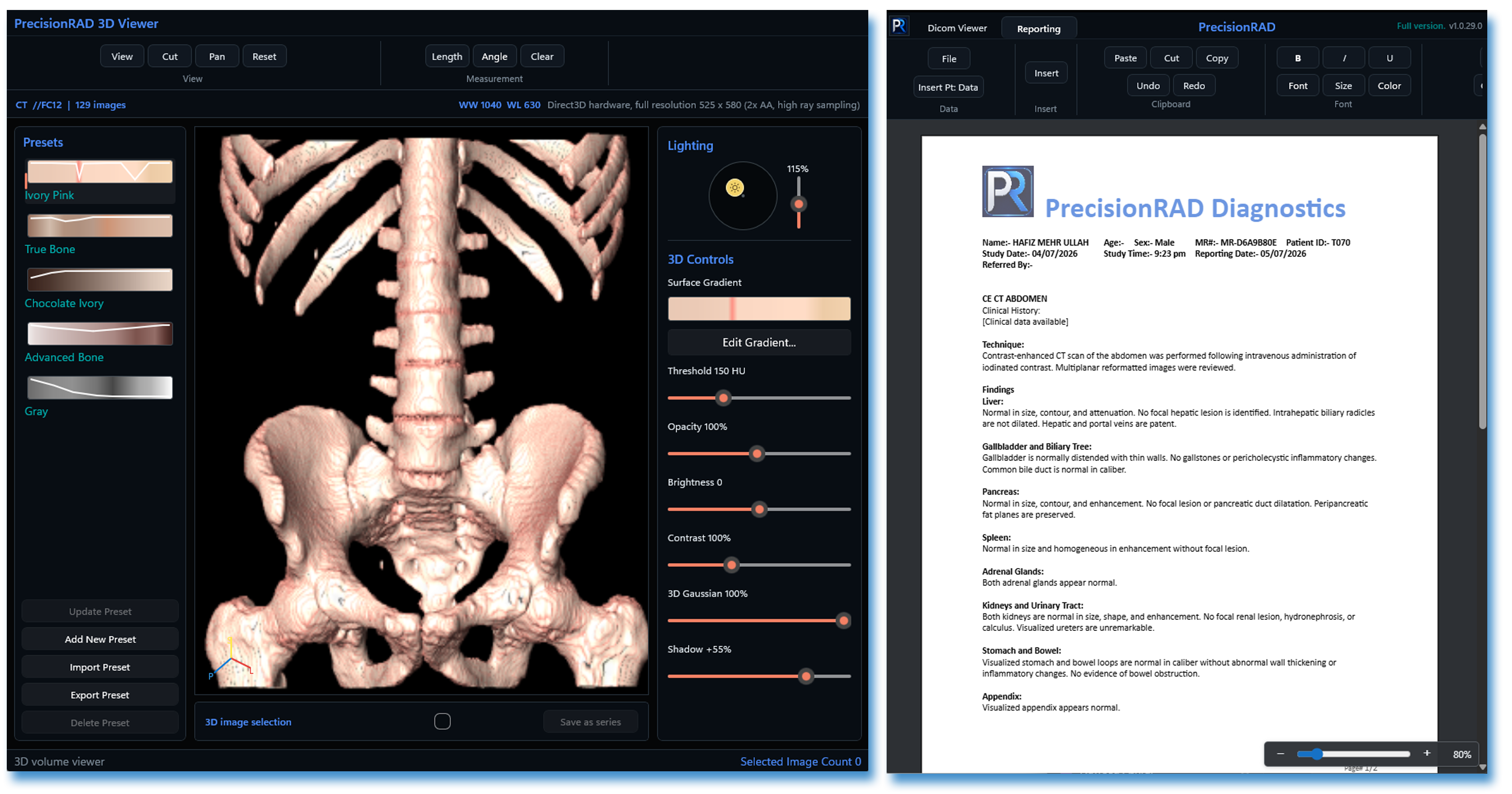 PrecisionRAD 3D volume rendering and radiology reporting workspaces